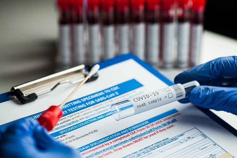 PCR検査を巡るドロ沼の様相